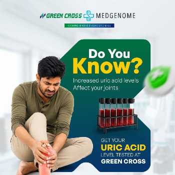 Uric Acid
