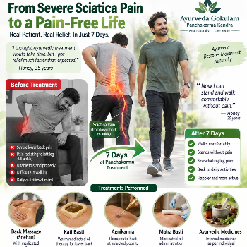 Severe Sciatica Pain Improved After 7 Days of Personalized Panchakarma Treatment