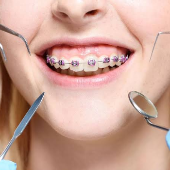 Comprehensive Dental Care Services at Sapphire Dental Orthodontic and Implant Centre