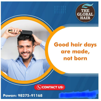 The Ultimate Guide to Hair Replacement Services: Exploring Global Hair Replacement in Indore