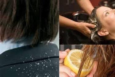 Say Goodbye to Dandruff: Transform Your Hair with Pluma Hair & Beauty Salon’s Dandruff Treatment