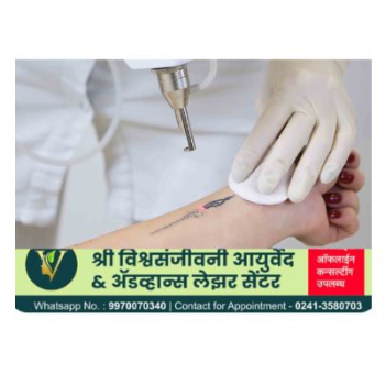 Rediscover Your Skin: Rachna’s Journey with Effective Tattoo Removal in India