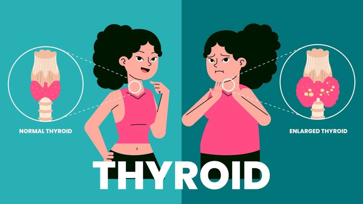 Transform Your Health: How Thyroid Profile Testing Can Change Lives