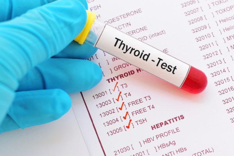 Unlock Your Health: How Thyroid Function Tests Transformed Lives