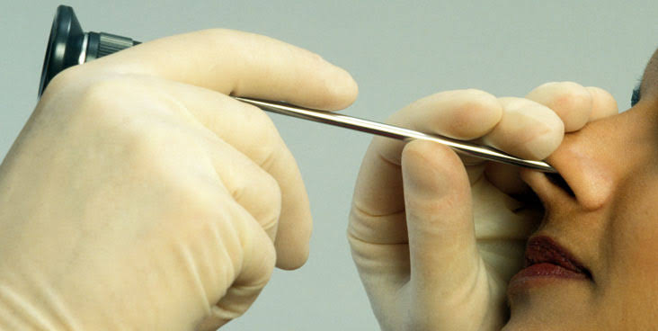 Breathe Freely Again: A Patient's Journey with Diagnostic Nasal Endoscopy