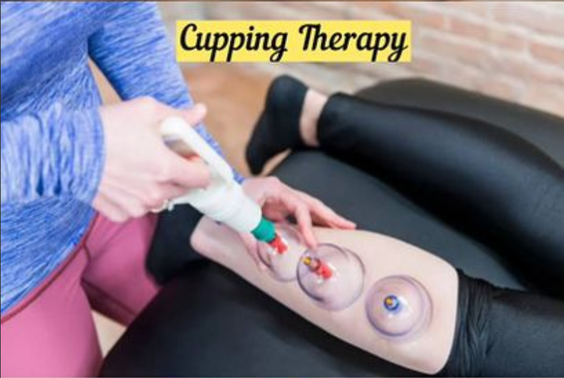 Relieve Your Pain: Discover the Benefits of Cupping Therapy at Dr. Medha’s Physio Clinic | Dr. Medha's Physiotherapy and Rehab Clinic, Pimple Saudagar