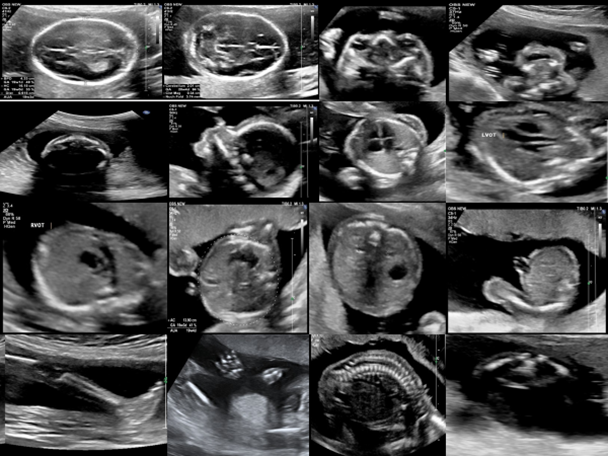 How Target Scan Revolutionizes Diagnostic Accuracy for Medical Professionals