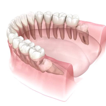 Say Goodbye to Wisdom Teeth Woes with Yashashree Dental Family Care