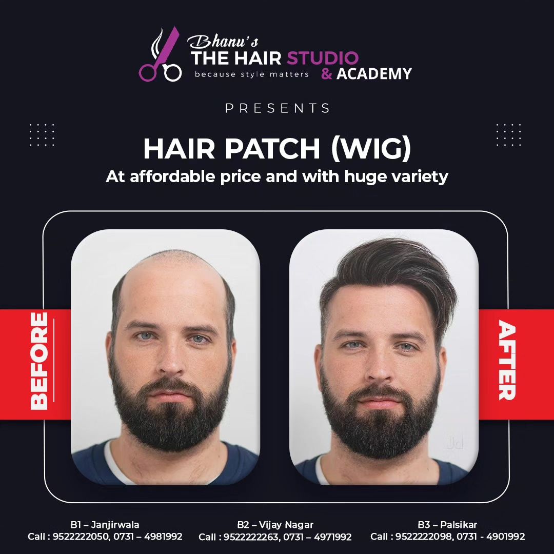 Transform Your Confidence with Hair Patching Solutions at Bhanu’s Hair Studio