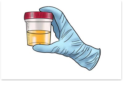 Transforming Health with a Simple Test: The Complete Urine Test Solution