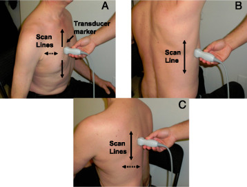 Transforming Healthcare: The Impact of Thoracic Ultrasonography on Indian Lives