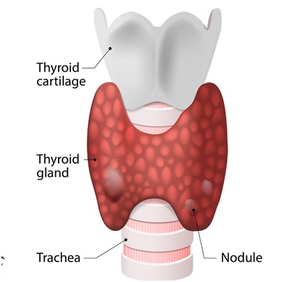 Empowering Lives: How Dr. Narseen Sheikh Transforms Thyroid Health