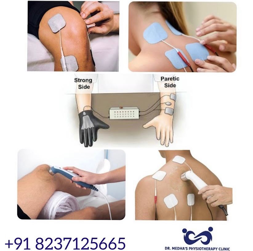 Relief at the Touch of a Button: How Electrotherapy Transforms Lives