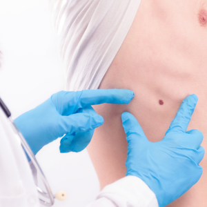 Transforming Lives: How Expert Oncological Surgery at Shree Hospital Offers Hope