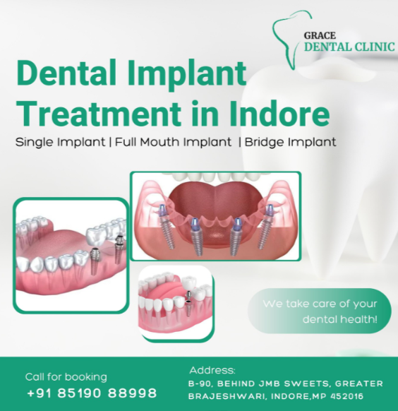 Transform Your Smile with Dental Implants: A New Beginning for Raj