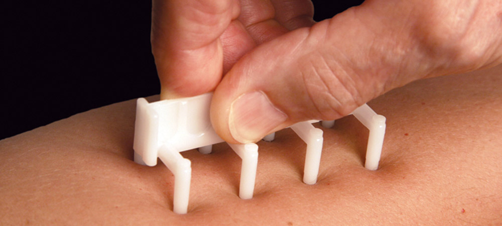 Finding Relief: How Allergy Testing Transformed Priya's Life