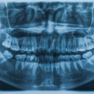 How Dental X-Ray Services at Malhar Dental Clinic Transform Smiles and Lives