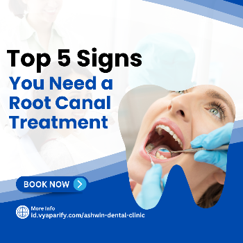 Top 5 Signs You Need a Root Canal Treatment