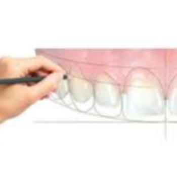 Transforming Smiles, Transforming Lives: The Journey of Smile Designing