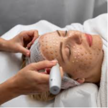Embrace Radiance: How BB Glow Facial Transforms Your Skin and Confidence
