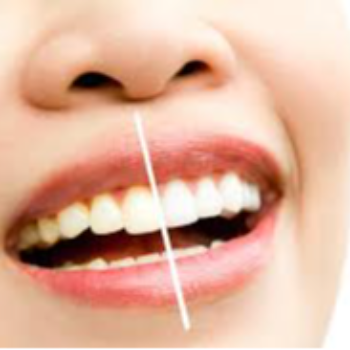 Transforming Smiles, Transforming Lives: The Power of Cosmetic Dental Surgery