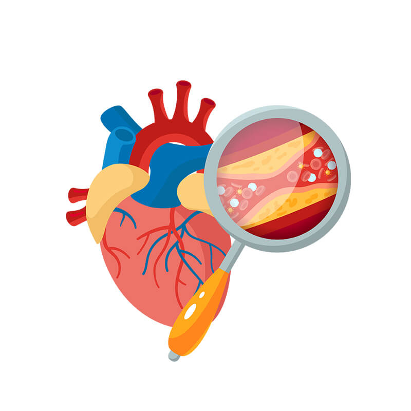 Transforming Health at Home: How Lipid Profile Services Empower Individuals