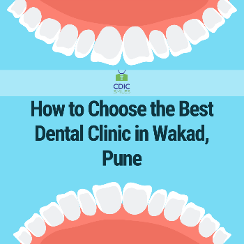 How to Choose the Best Dental Clinic in Wakad, Pune