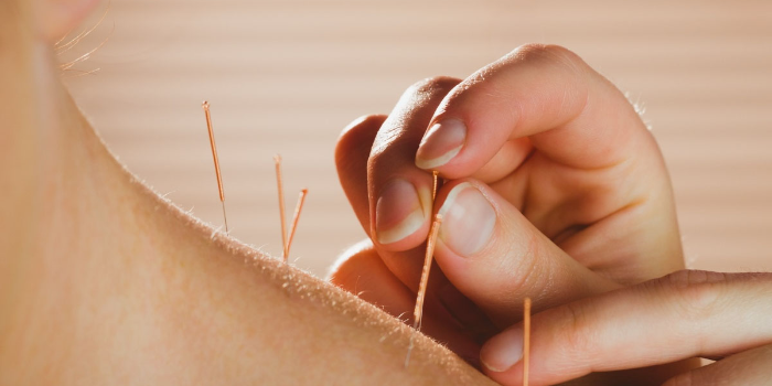 Banner SHIVANJALI ACCUPUNTURE & NATUROPATHY CLINIC