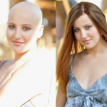 Chemotherapy wigs-https://i-media.vyaparify.com/vcards/products/120525/product_1737556926.png Image