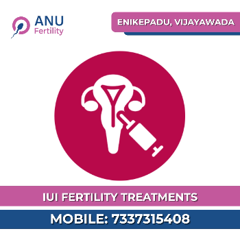 IUI Treatment-https://i-media.vyaparify.com/vcards/products/172284/product_1742883268_67e249c4c9fa5.png Image