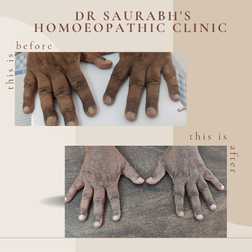 Homoeopathy Dr SAURABH'S HOMOEOPATHIC CLINIC Pune, Maharashtra 411046, India