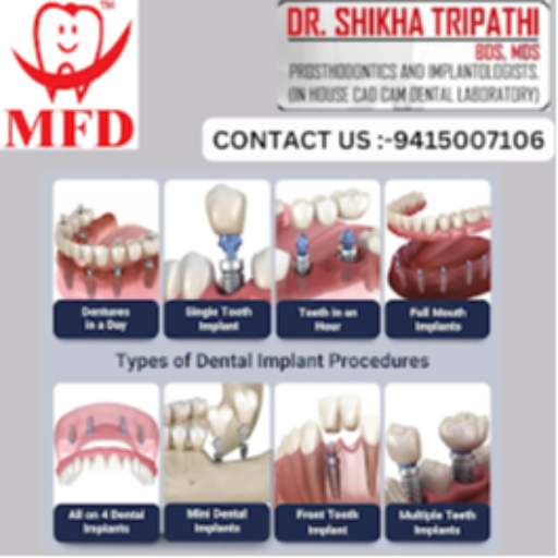 Dental Implant My Family Dentist Dental Implant Center (MFD-HARIDWAR) Haridwar, Uttarakhand 249403, India