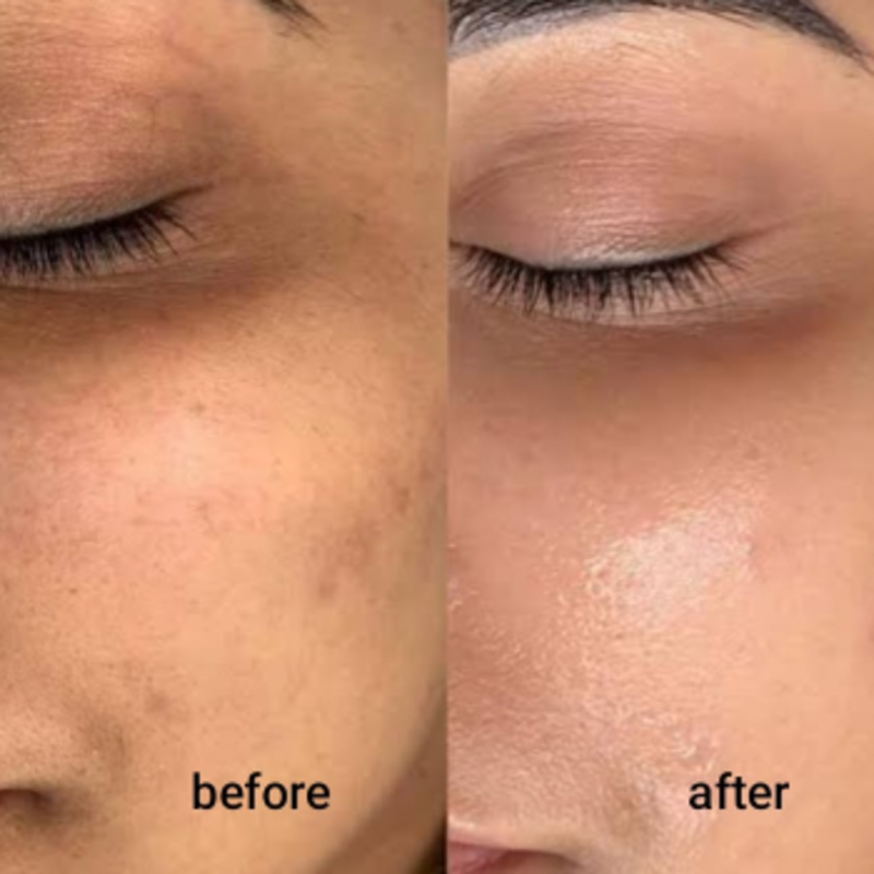 Best Skin Treatments in Pune | Shree Sai Clinic-https://i-media.vyaparify.com/vcards/products/302476/product_1756549671_68b2d2279c32f.jpeg Image