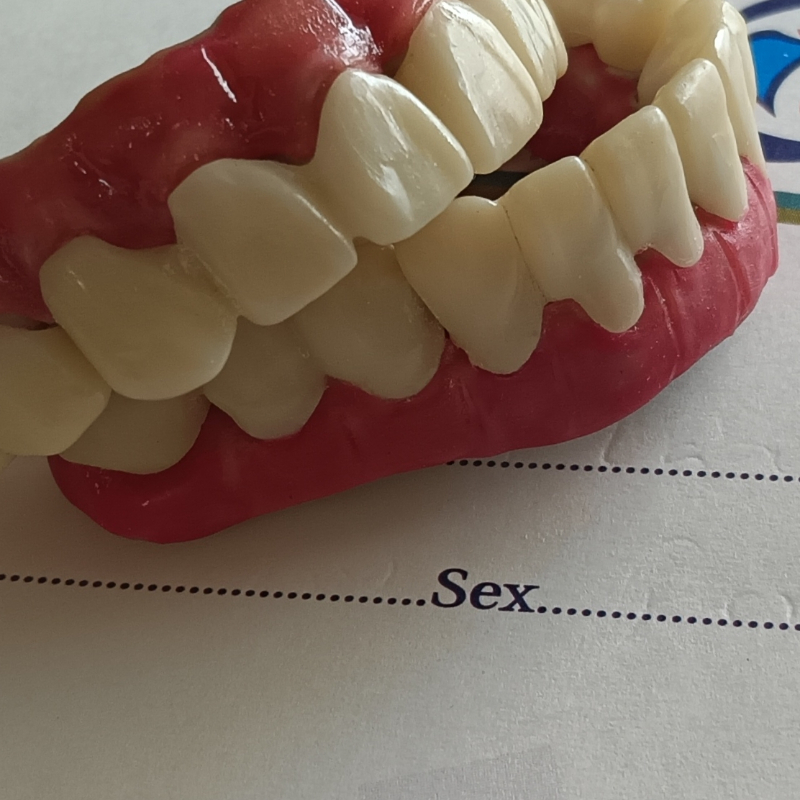 Metal Ceramic Crown In Hasthinapuram-https://i-media.vyaparify.com/vcards/products/302617/product_1756825799_68b708c77a2c3.jpeg Image