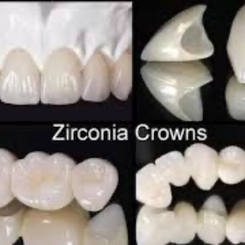 Zirconium Crown In Hasthinapuram-https://i-media.vyaparify.com/vcards/products/302718/product_1757011439_68b9ddef84e46.jpeg Image