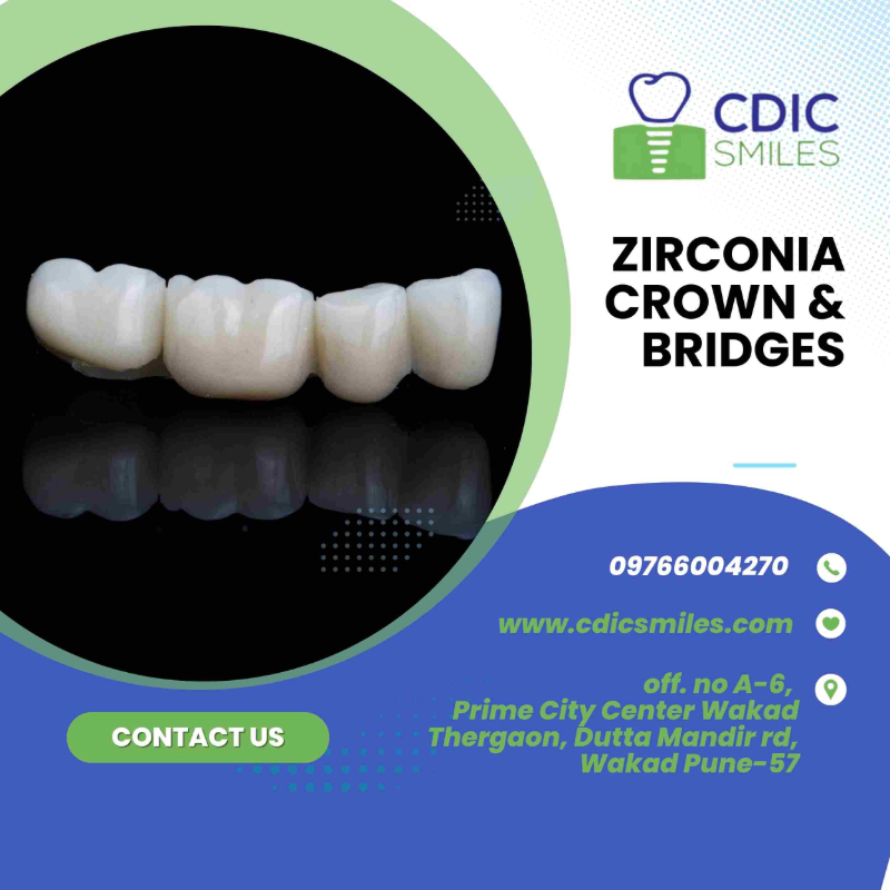 Impacted Wisdom Tooth Surgery in Wakad, Pune | Safe & Pain-free-https://i-media.vyaparify.com/vcards/products/303890/product_1758527448_68d0ffd8b08b2.png Image