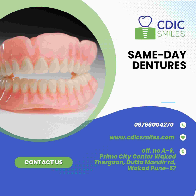 Same-Day Dental Implants in Wakad, Pune | Immediate Smile Restoration-https://i-media.vyaparify.com/vcards/products/304275/product_1758961712_68d7a03011172.jpeg Image