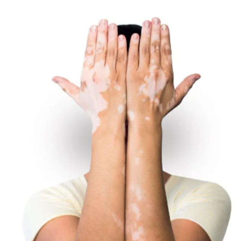 Expert Homeopathy Treatment in Thane for Chronic & Autoimmune Diseases-https://i-media.vyaparify.com/vcards/products/305846/product_1764220434_6927de125e4fe.jpeg Image