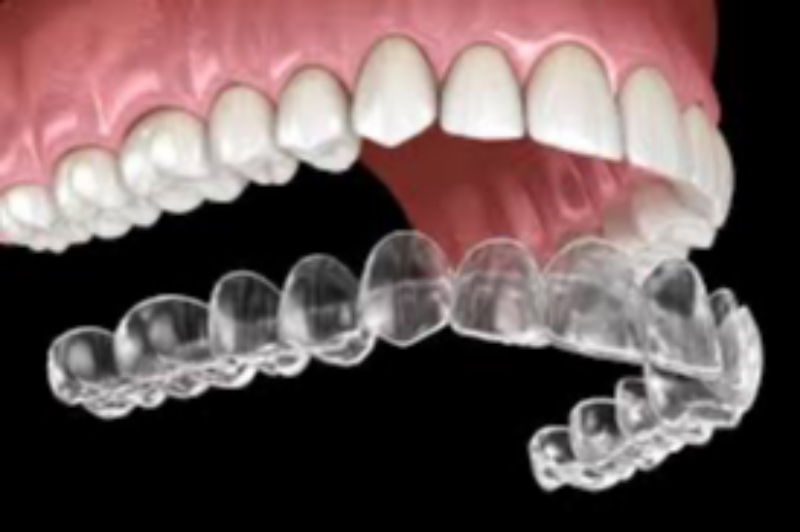 Invisalign Aligners In Hasthinapuram At Dr Care Dental Hospital-https://i-media.vyaparify.com/vcards/products/307382/product_1768288664_6965f198336fe.jpeg Image