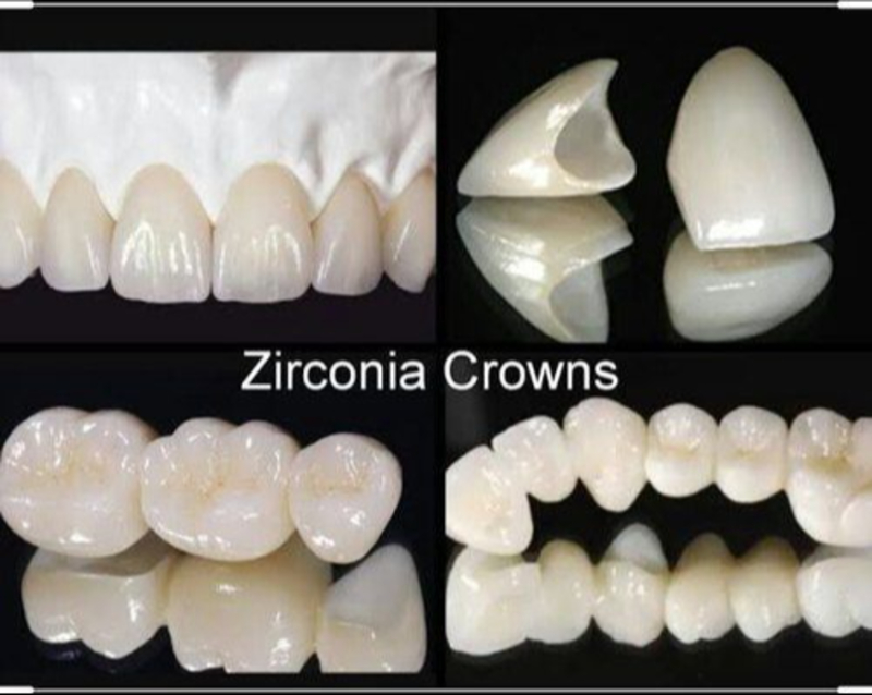 Dr Care Dental Hospital For Zirconium Crown In Hyderabad Telangana India-https://i-media.vyaparify.com/vcards/products/309854/product_1772076029_699fbbfd20b72.jpeg Image