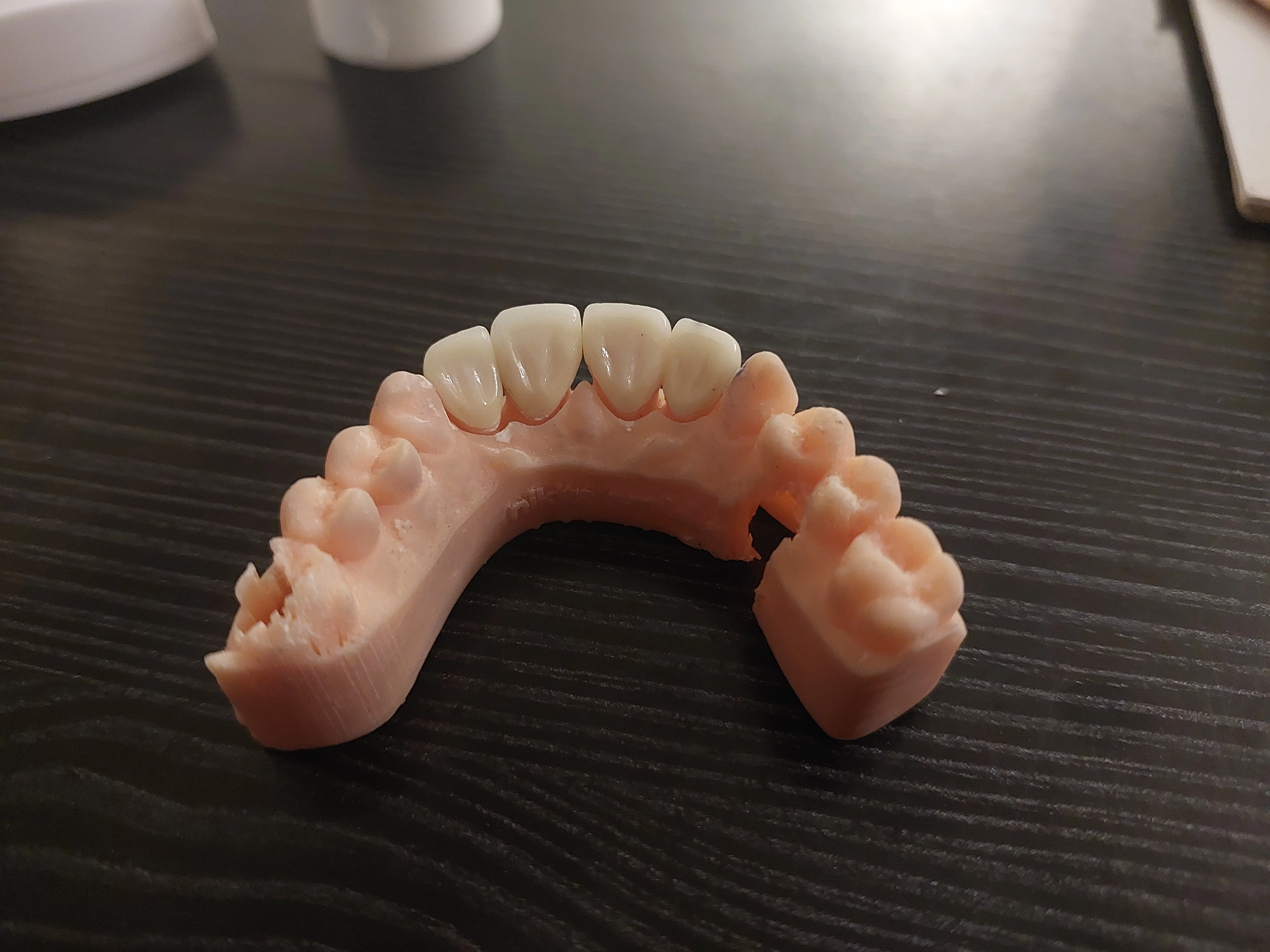 Crowns and Bridges in Jaipur Smile Carve Dental Clinic & Facial Aesthetic Center Nandan Apartment, C 72 Sarojini Marg, C Scheme