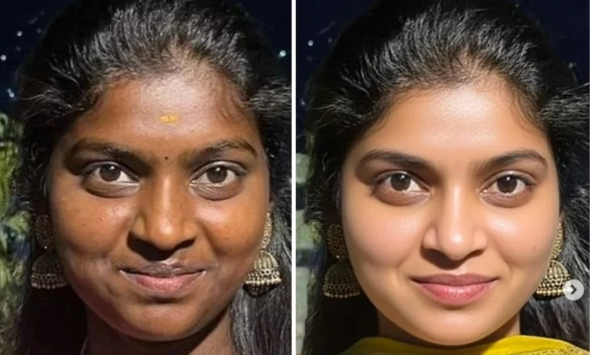 Mehak Pigmentation Night Cream 20 gm in Hyderabad product image