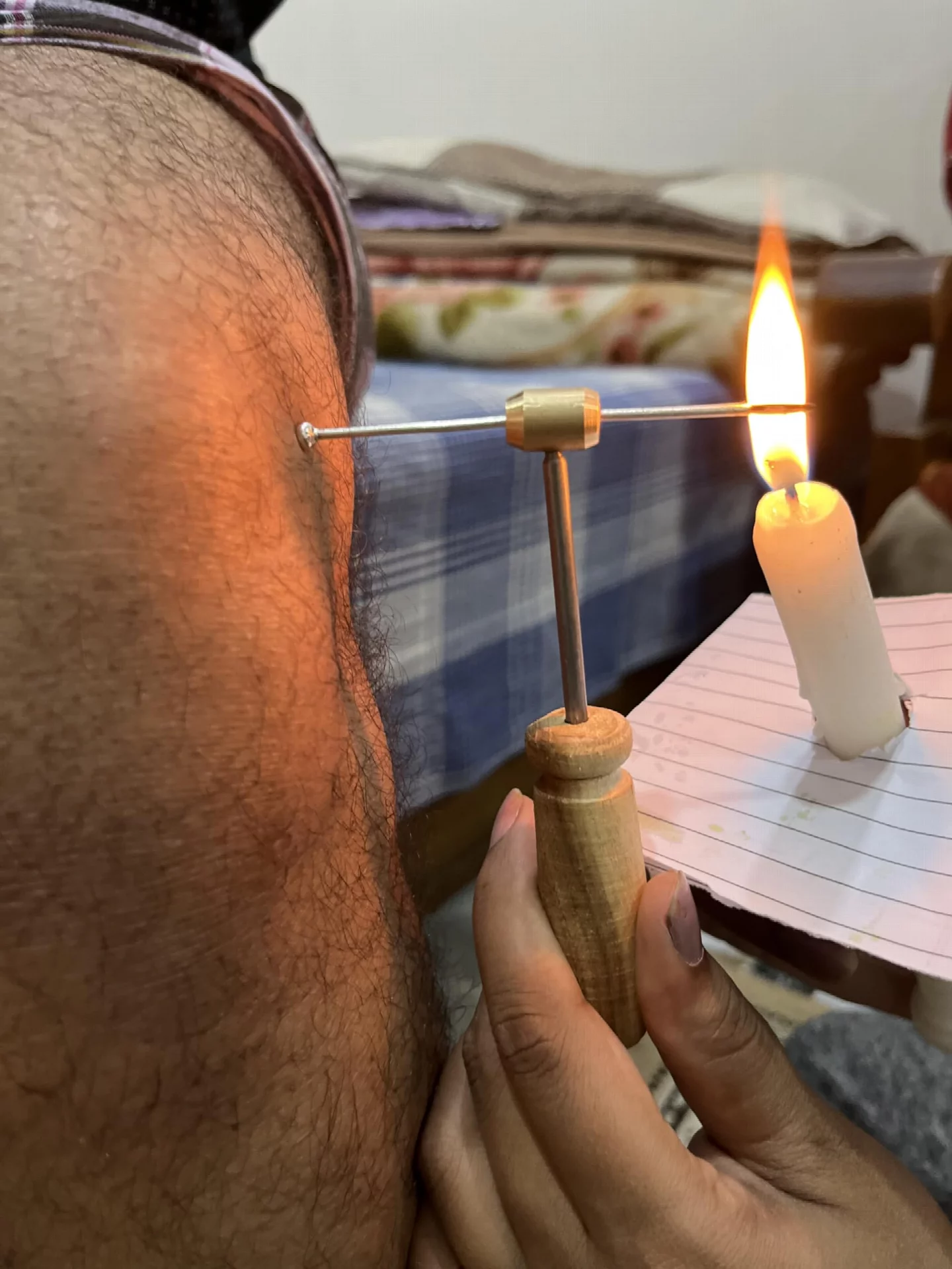 Agnikarma Swarna Shalaka
