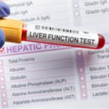 Liver Function Test-https://i-media.vyaparify.com/vcards/products/49095/product_1719054496.png Image