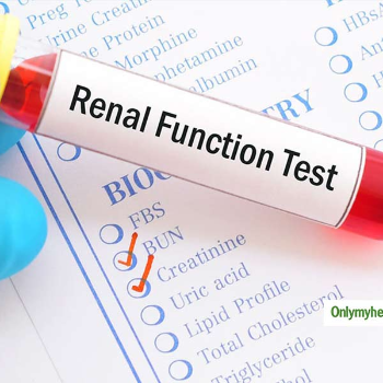 Renal Function Test-https://i-media.vyaparify.com/vcards/products/49547/product_1719054385.png Image