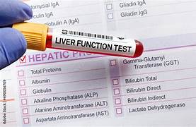 Liver Function Test-https://i-media.vyaparify.com/vcards/products/57774/th.jpeg Image