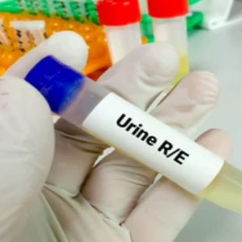 Urine R & M-https://i-media.vyaparify.com/vcards/products/74064/product_1728902465.png Image