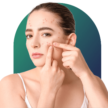 Acne / pimples Treatment | TEJ SKIN & COSMETIC CLINIC | Shop No 3, Arihant Apartment, Sinhgad Institute Road, Near Bank Of  Maharashtra , Ambegaon Budruk, Pune,         Maharashtra 411046,          India