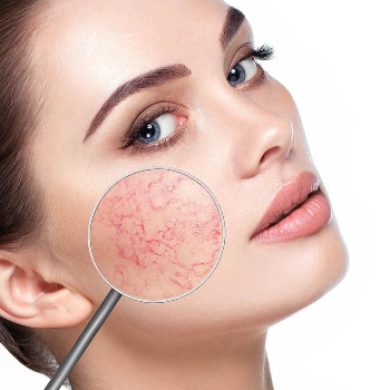 Skin Issues | TEJ SKIN & COSMETIC CLINIC | Shop No 3, Arihant Apartment, Sinhgad Institute Road, Near Bank Of  Maharashtra , Ambegaon Budruk, Pune,         Maharashtra 411046,          India