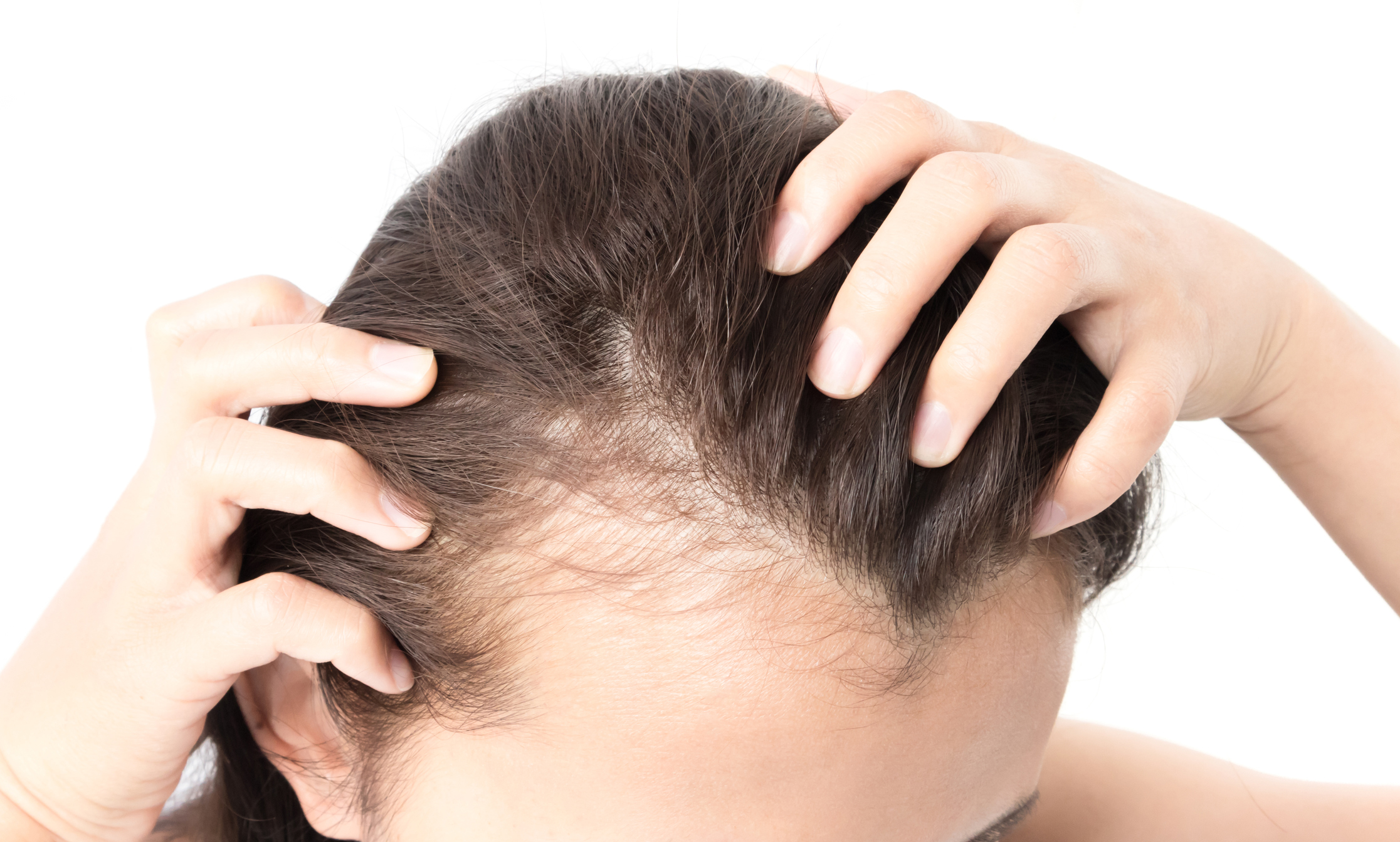 Hairloss Treatment | Dr. Vaishnavi's Skin Hair Laser Clinic | 